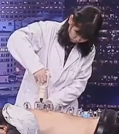 排寒利湿的拔罐方式